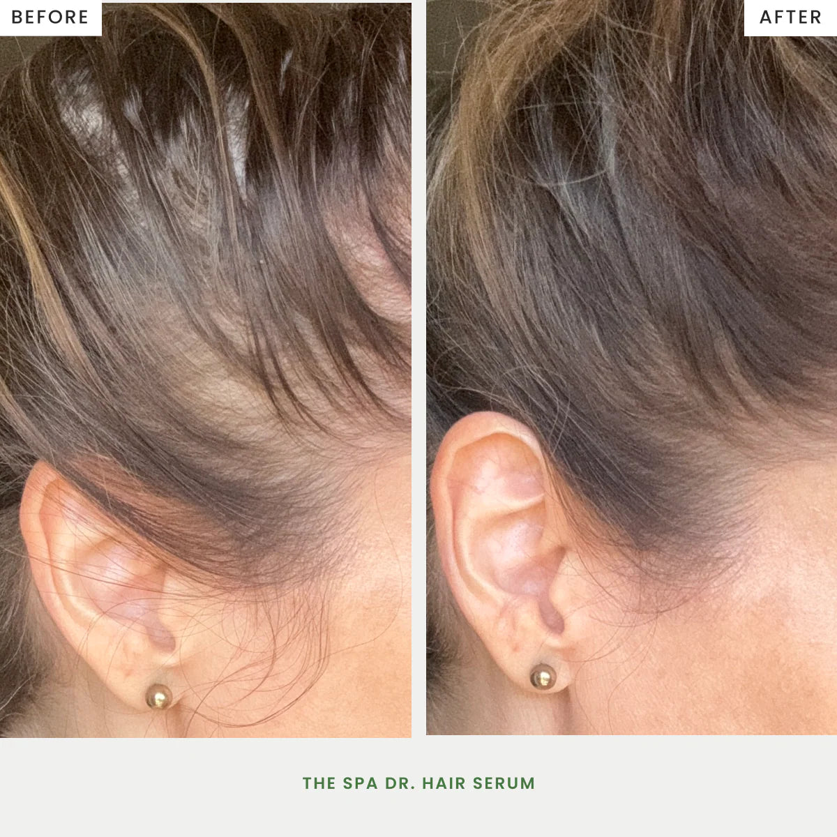 Hair Serum